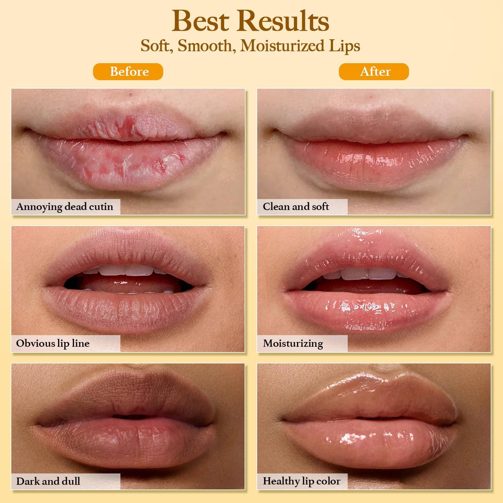 MUREND before and after lip comparison showing smoother, more even-looking lips