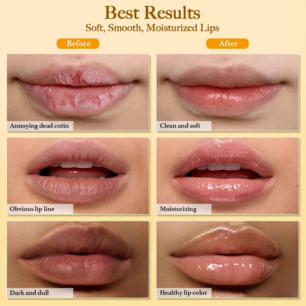 MUREND before and after lip comparison showing smoother, more even-looking lips