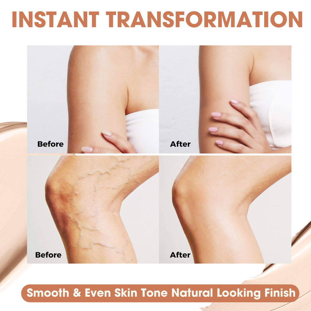 MyTend before and after on leg demonstrating visible tattoo concealment