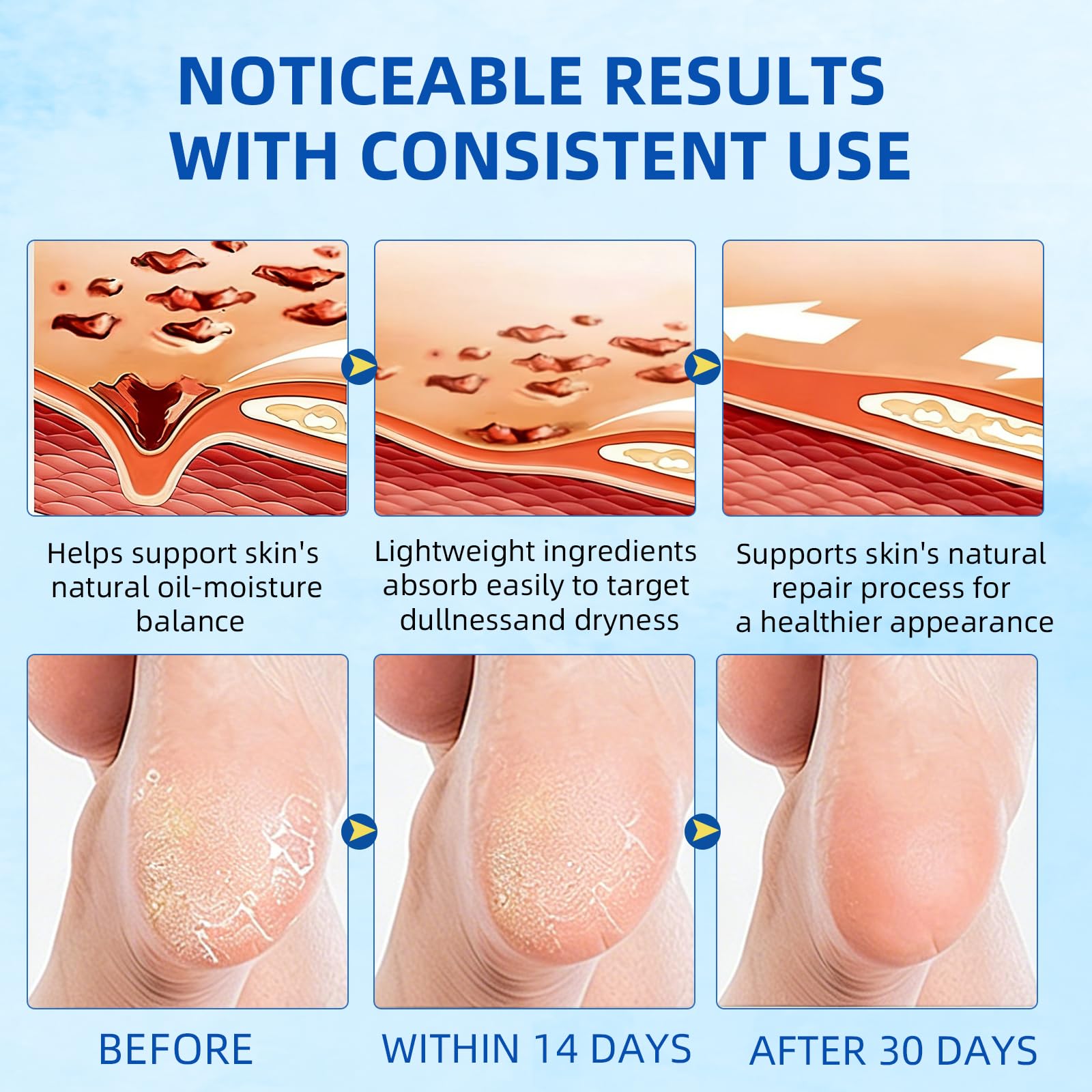 MZWFAH before and after heels comparison showing smoother, softened skin