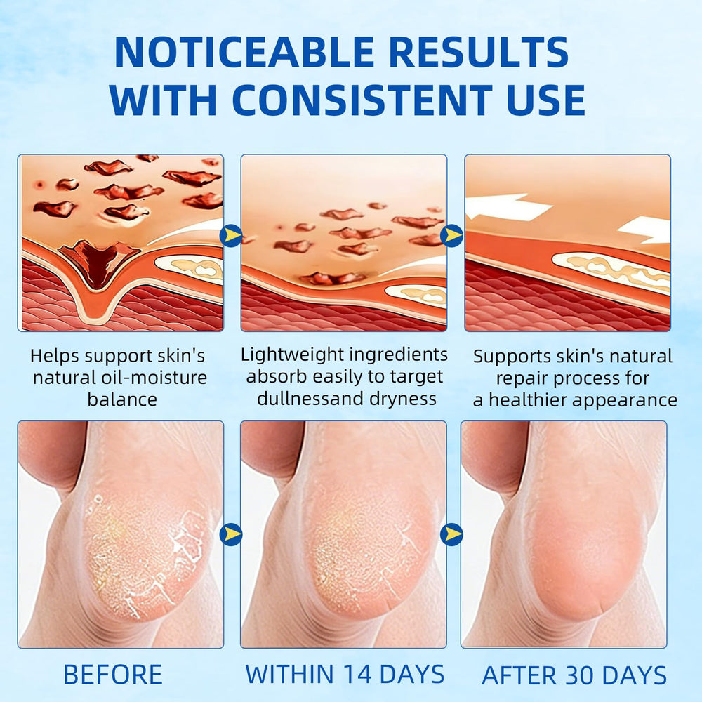 MZWFAH before and after heels comparison showing smoother, softened skin