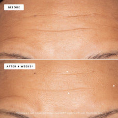 Naked & Thriving 35 ml bottle next to ruler showing compact travel-friendly benefit