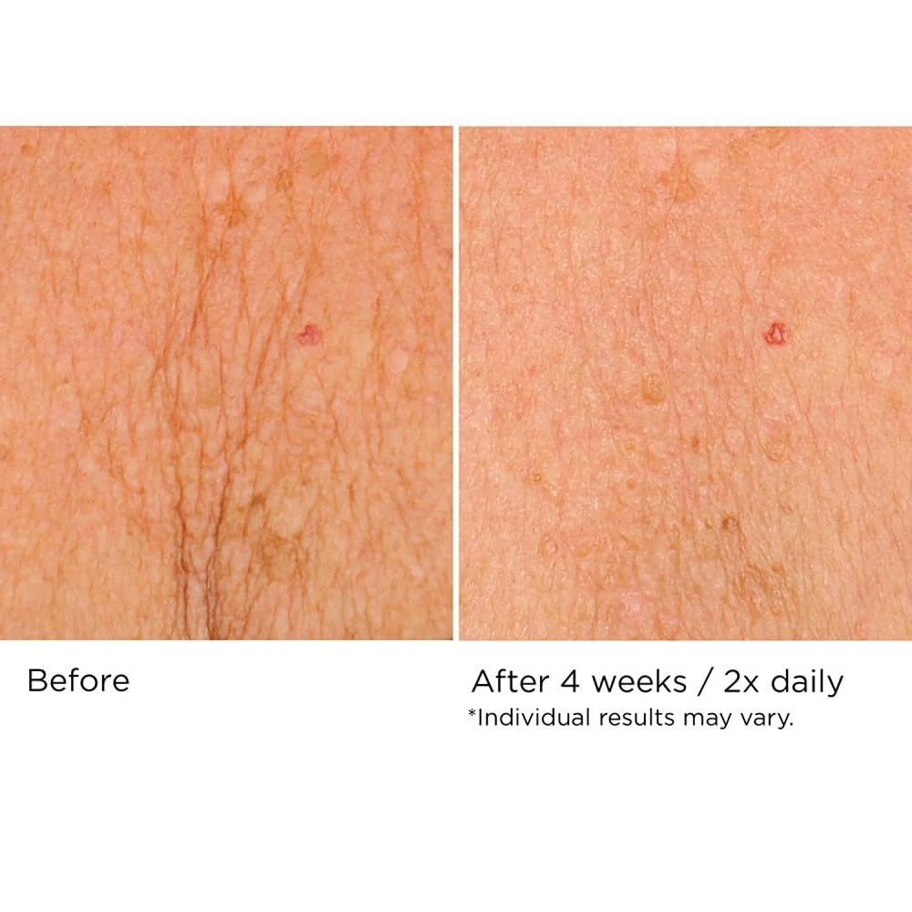 NASSIFMD application on neck demonstrating smoothing and hydration benefit