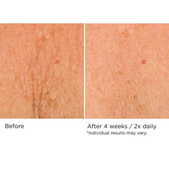 NASSIFMD application on neck demonstrating smoothing and hydration benefit