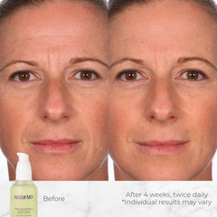 NASSIFMD close-up of golden serum drop highlighting silky texture and absorption