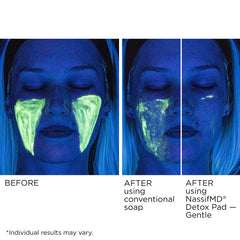 NassifMD ingredient display with glycolic and vitamin C for brightening