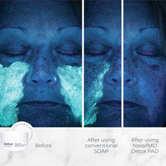 NASSIFMD close-up of pad texture and saturated solution for gentle exfoliation