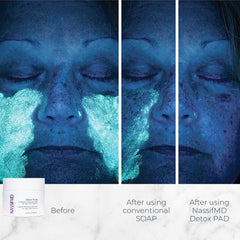 NASSIFMD close-up of pad texture highlighting gentle exfoliation