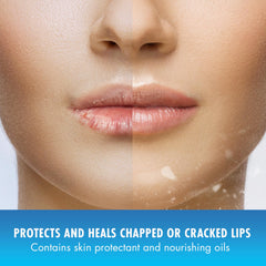 Natural Ice label detail showing SPF 15 and medicated formula benefits