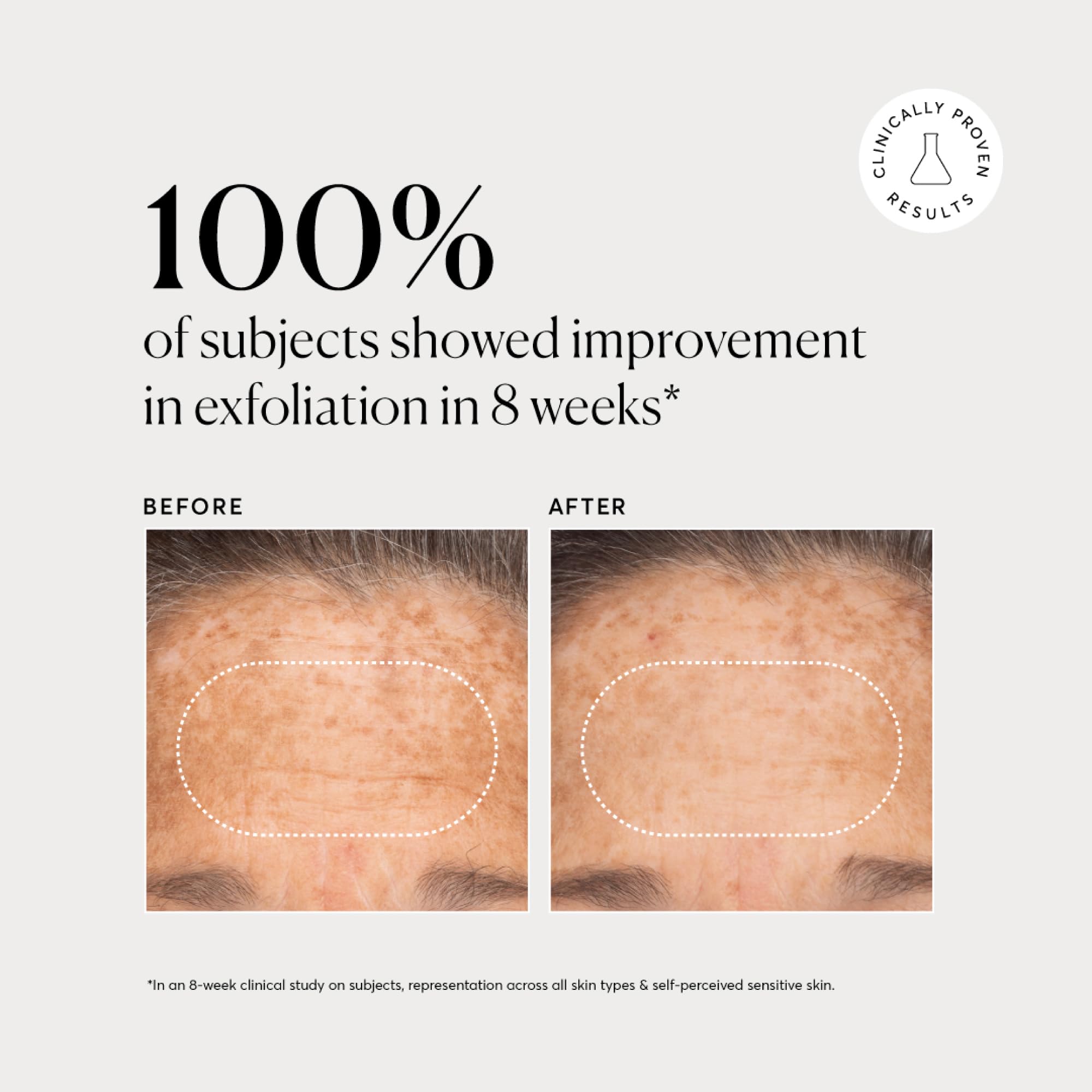 Naturium applied to hand showing even spread and gentle skin compatibility