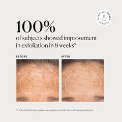 Naturium applied to hand showing even spread and gentle skin compatibility