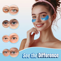 NAZANO both patches positioned under eyes showing balanced placement benefit