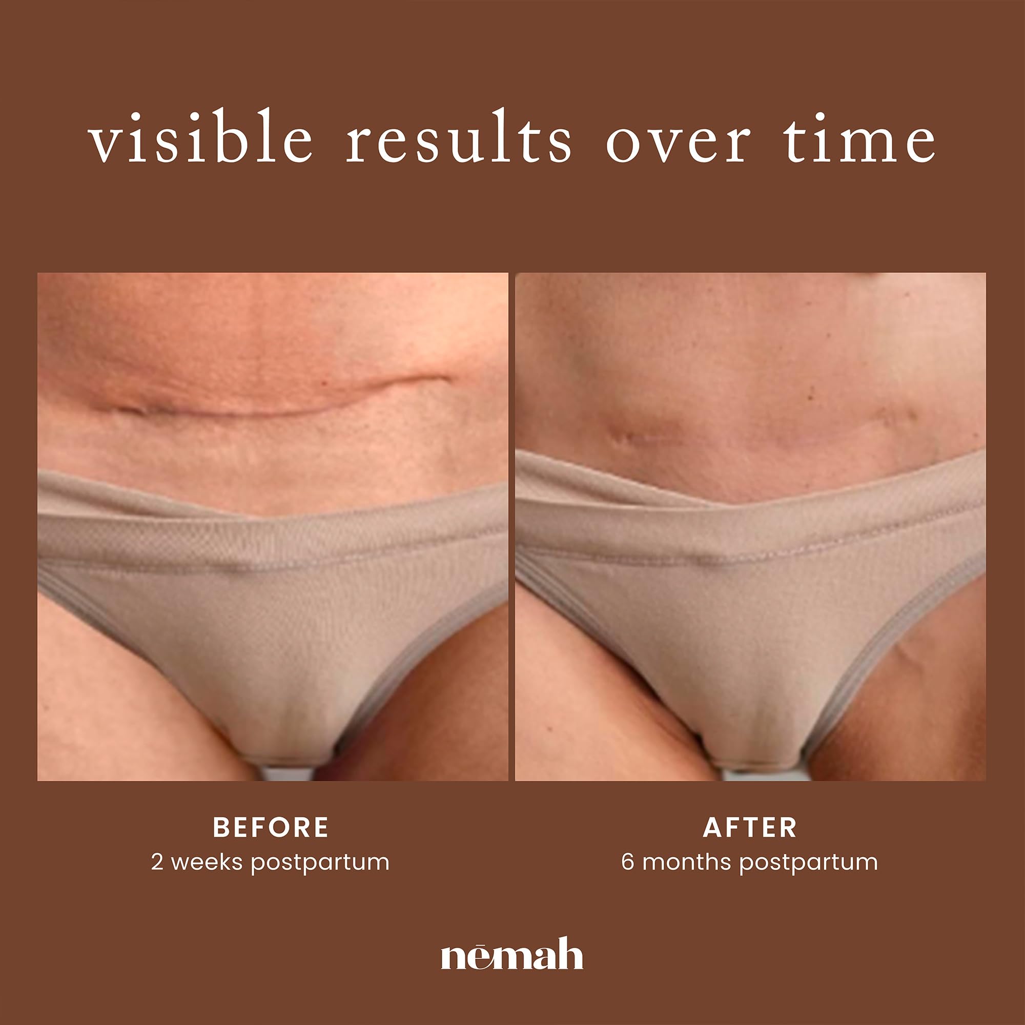 Nemah lifestyle postpartum use on bed showing easy twice-daily routine