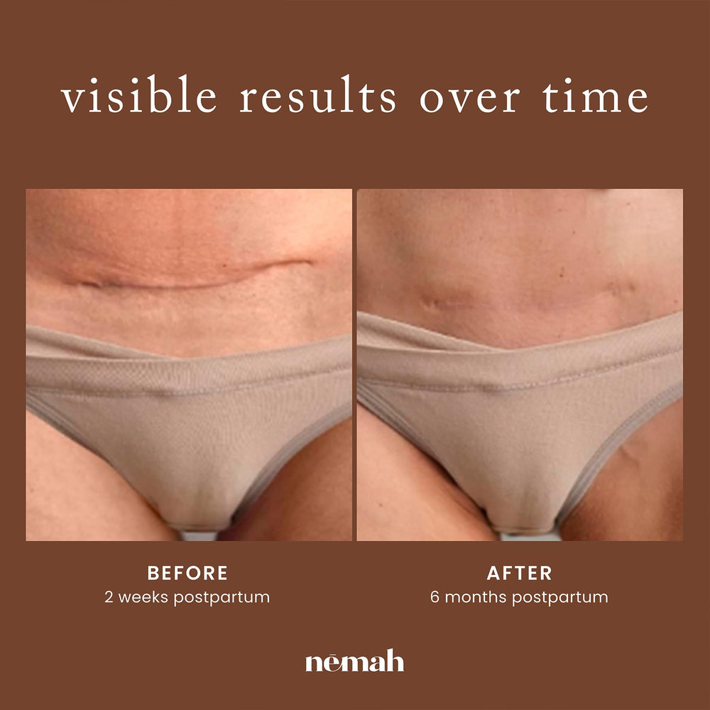 Nemah lifestyle postpartum use on bed showing easy twice-daily routine