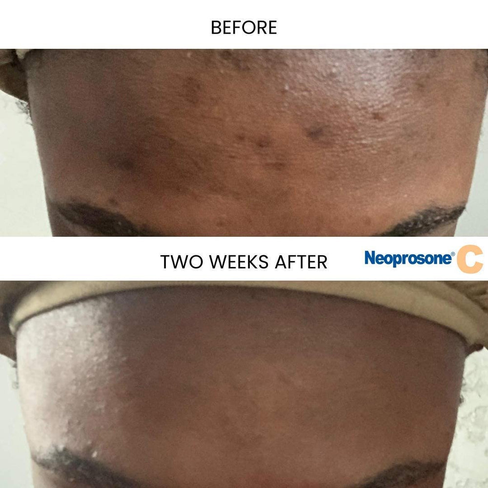 Neoprosone serum texture spread on skin, lightweight finish for quick absorption