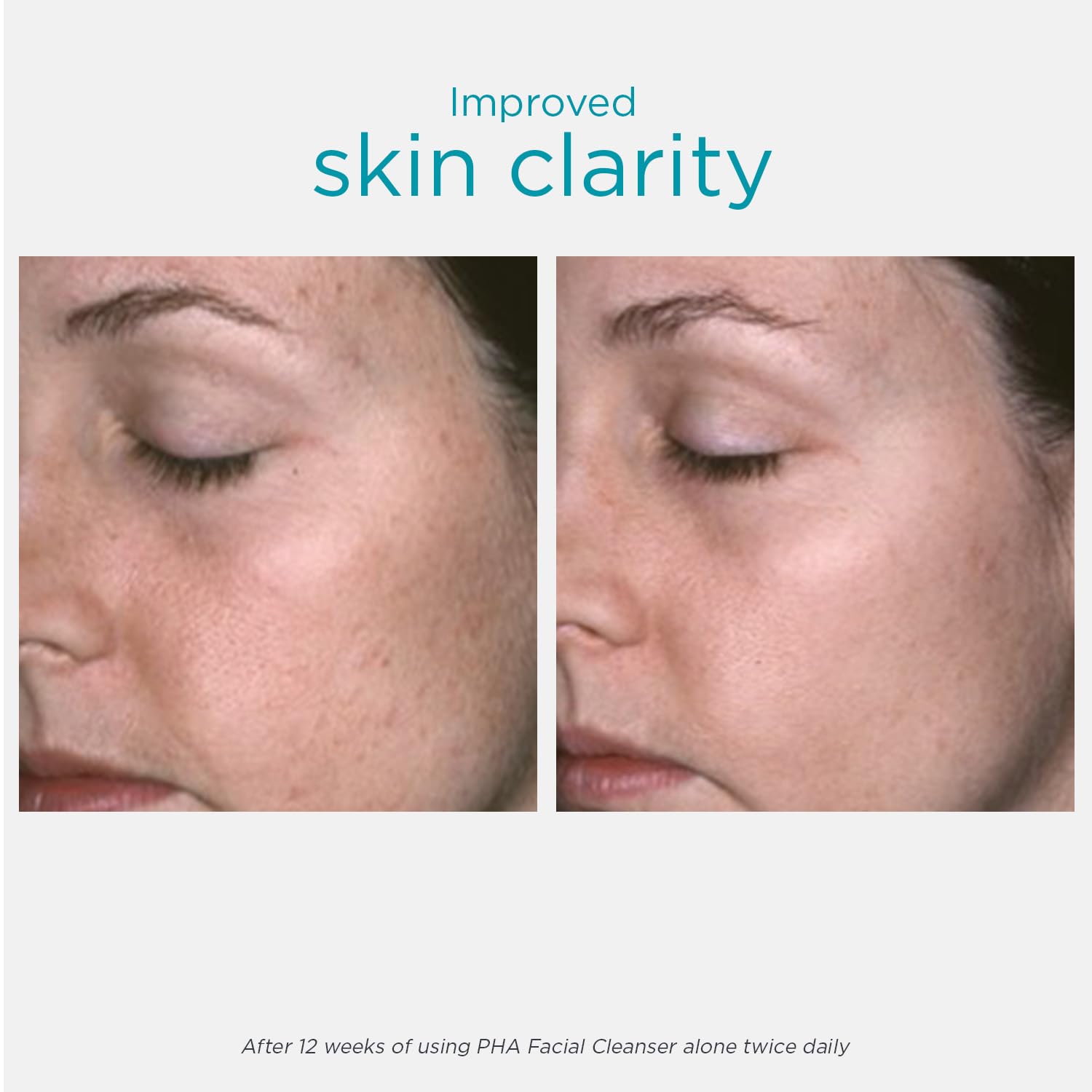 NEOSTRATA clear gel texture detail illustrating gentle non-foaming formula