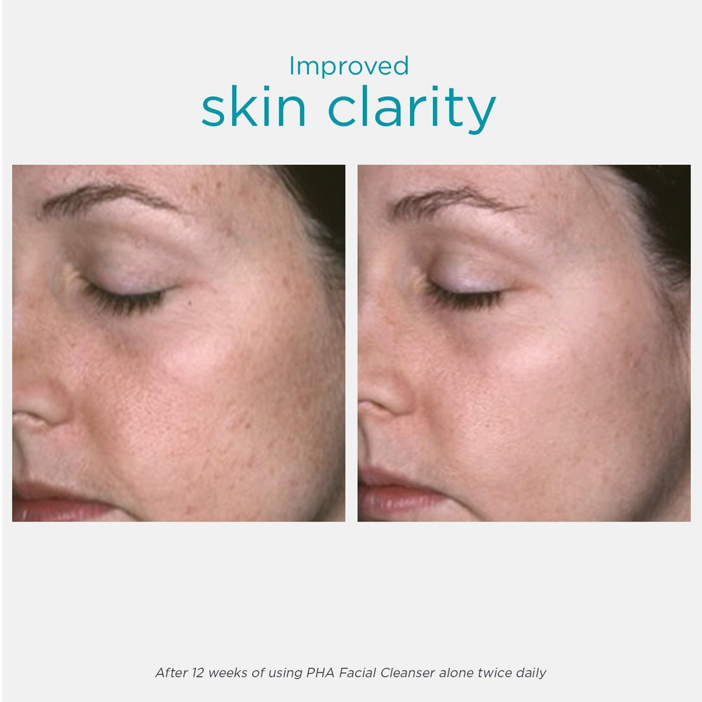 NEOSTRATA clear gel texture detail illustrating gentle non-foaming formula