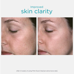 NEOSTRATA clear gel texture detail illustrating gentle non-foaming formula