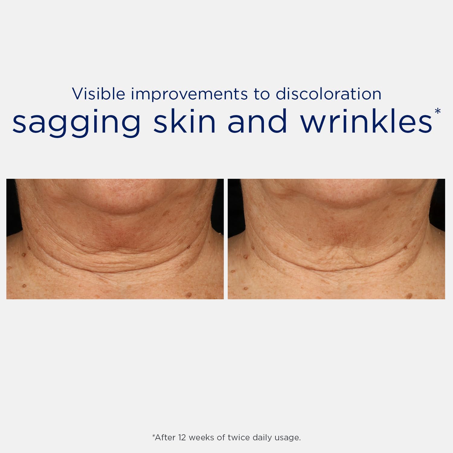 NEOSTRATA label detail highlighting active ingredients and clarity benefit