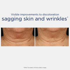 NEOSTRATA label detail highlighting active ingredients and clarity benefit