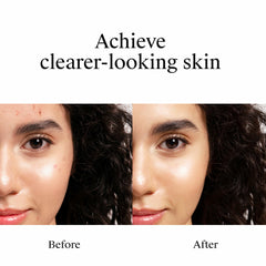 Neutrogena application on fingertip illustrating precise spot coverage