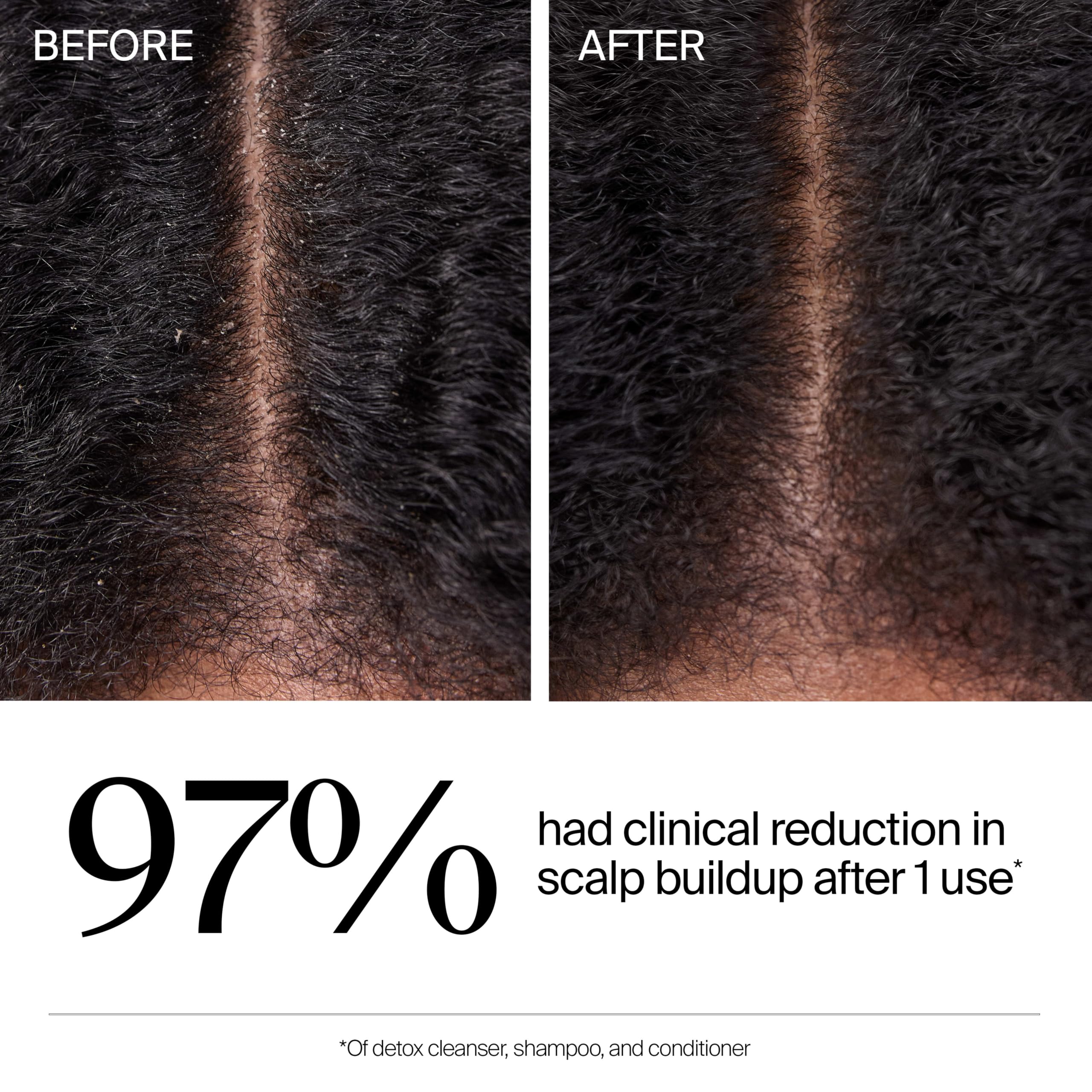Neutrogena ingredient focus with hyaluronic and acids supporting scalp clarity