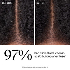 Neutrogena ingredient focus with hyaluronic and acids supporting scalp clarity