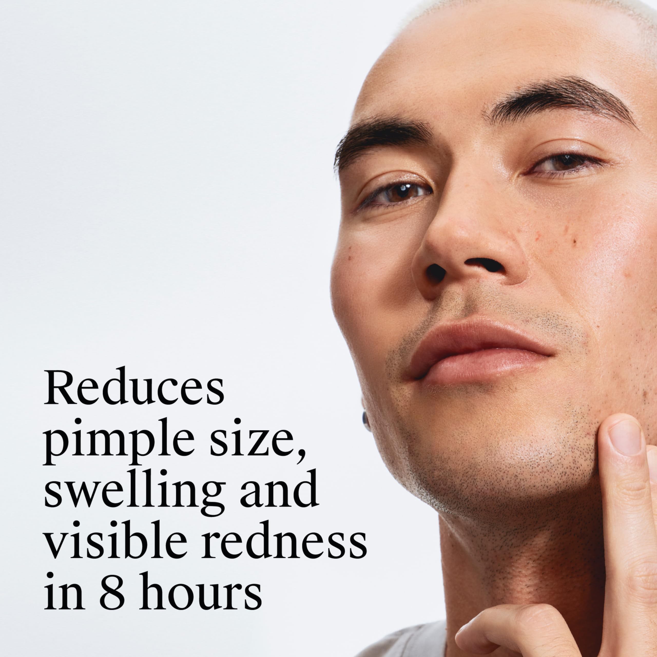 Neutrogena product label close-up highlighting 2% salicylic acid ingredient benefits