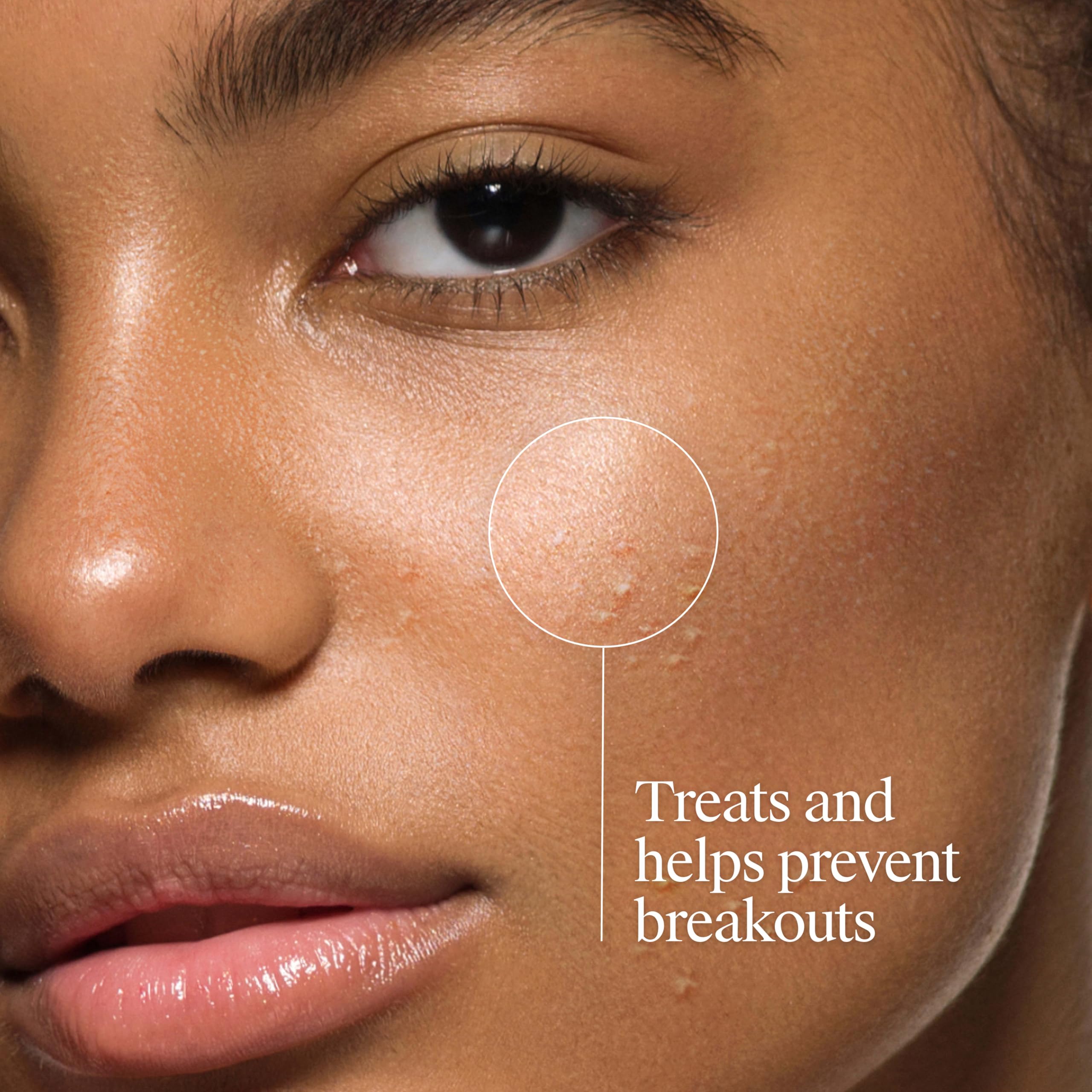 Neutrogena label ingredients and active 2% salicylic acid highlighting treatment strength benefit: targeted action