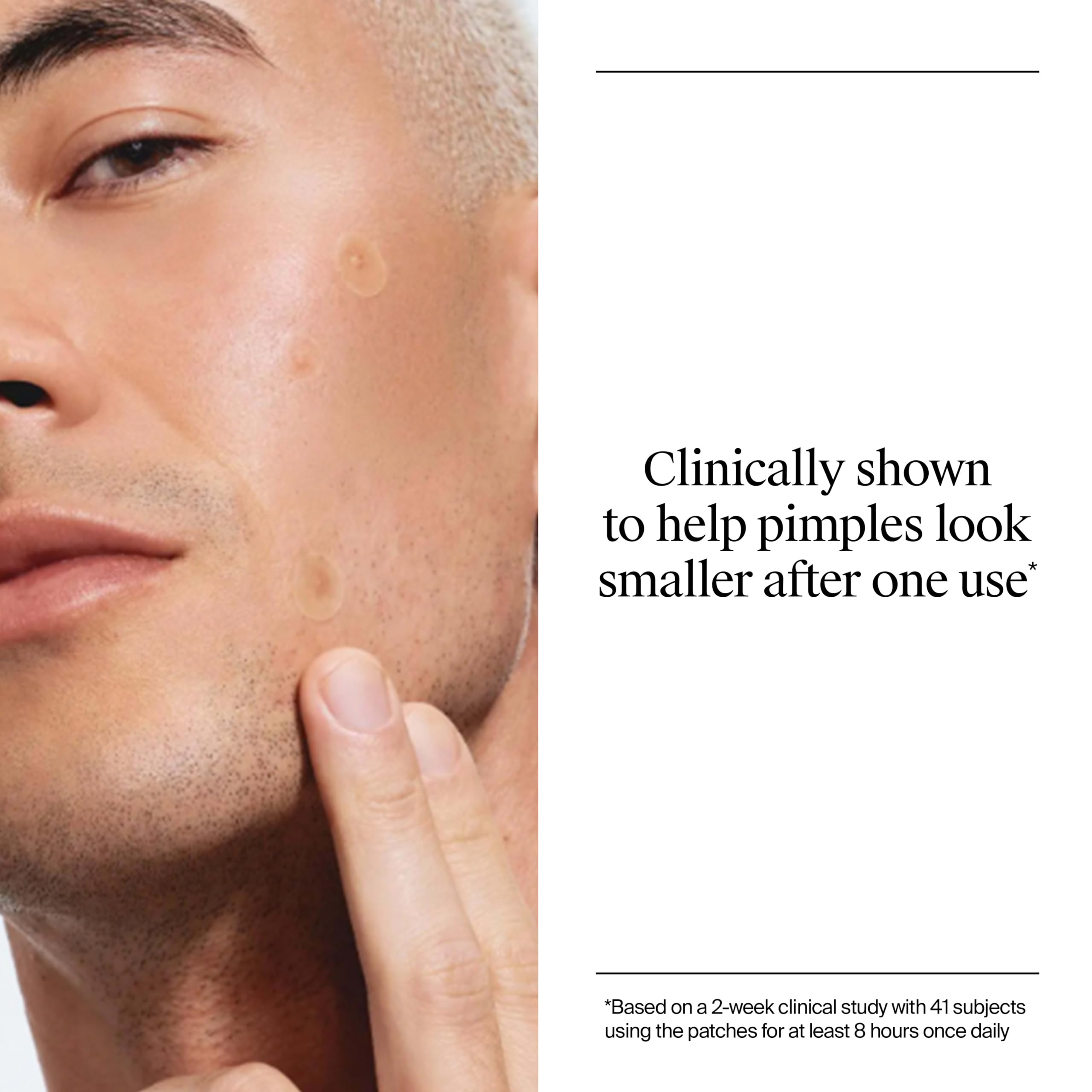 Neutrogena patch sealing blemish to block picking and protect healing