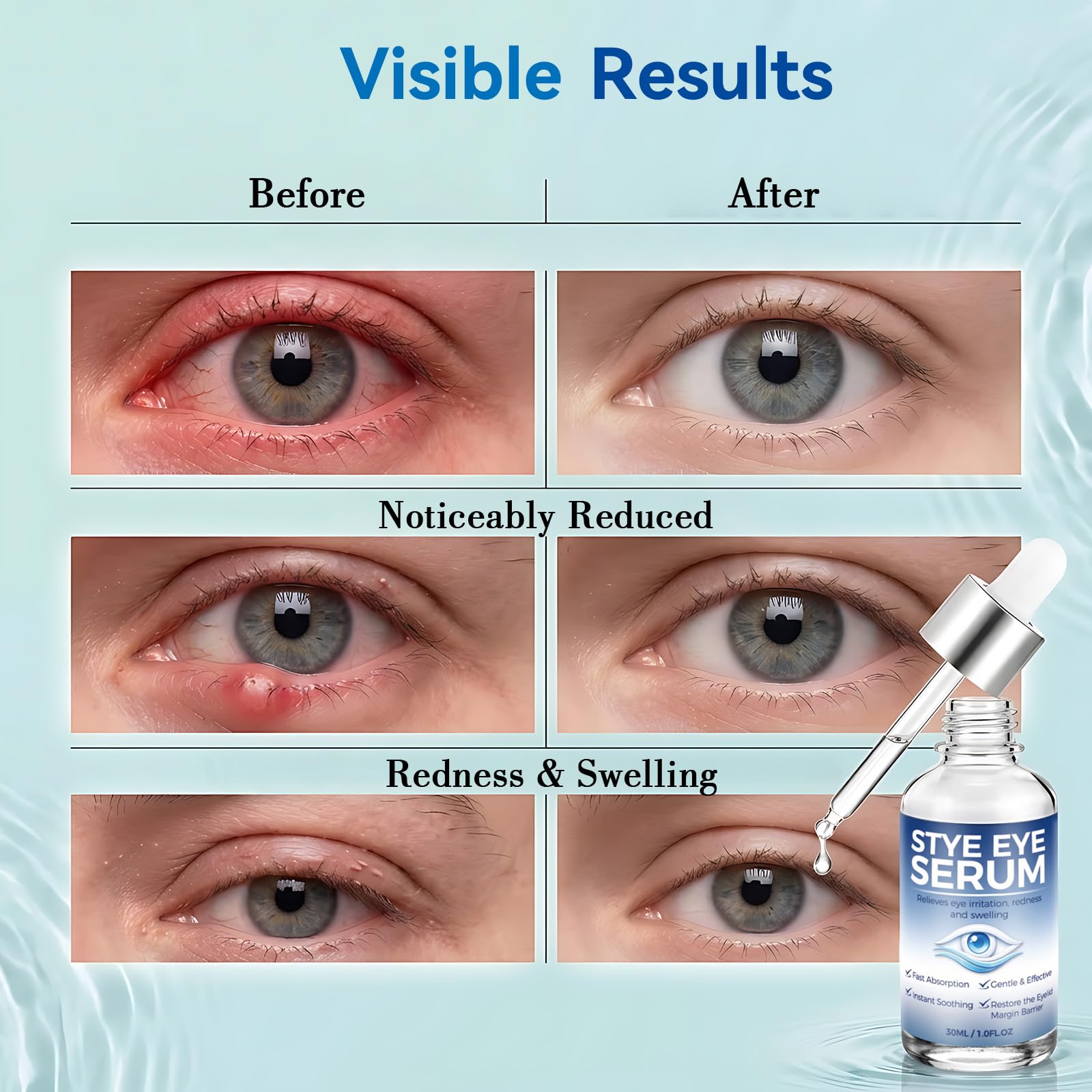 Nexkayee applying serum gently to eyelid highlighting targeted soothing benefit