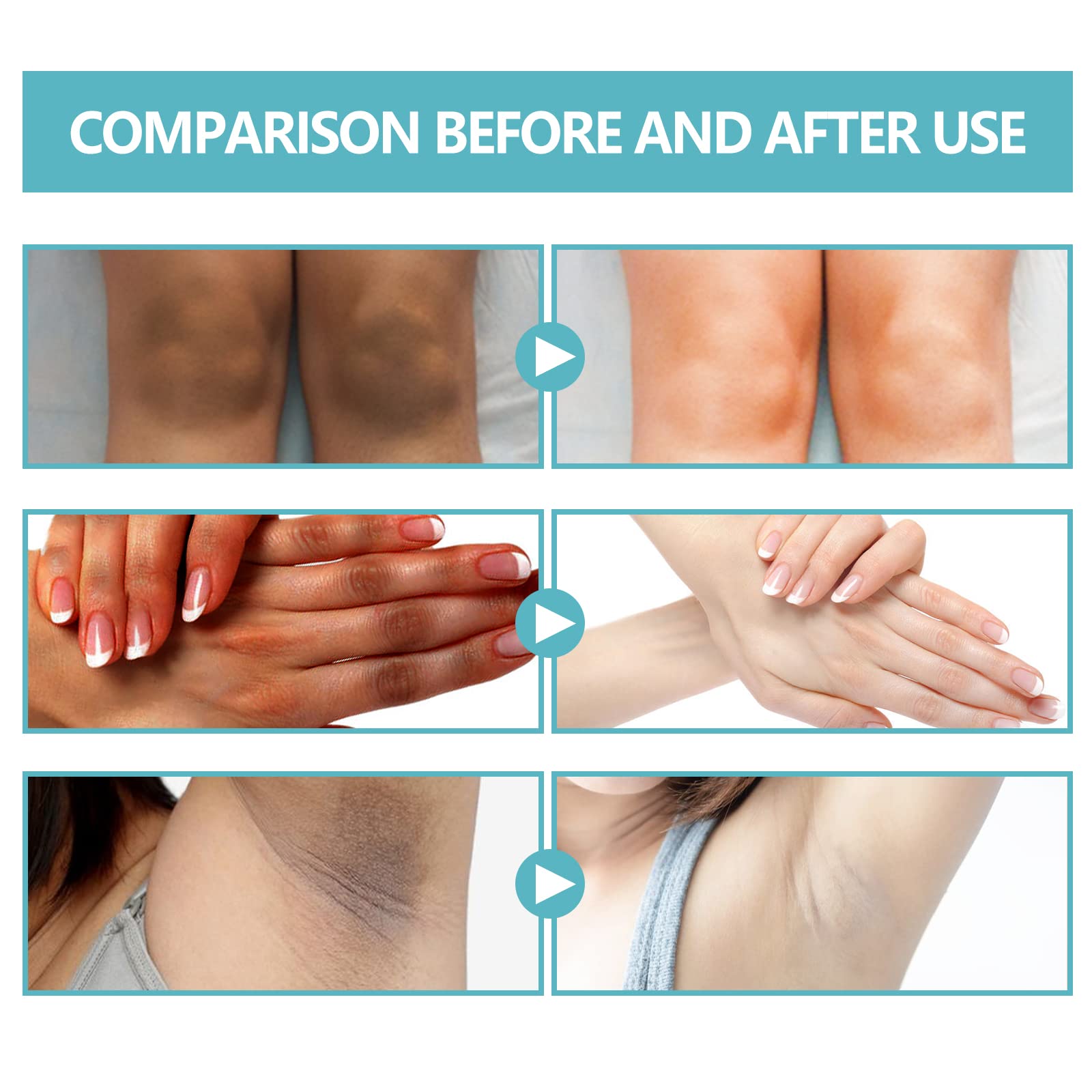 Nigrifix label close-up listing retinol and lactic acid benefits
