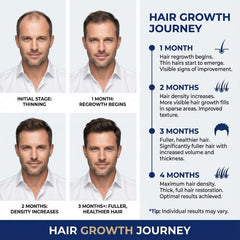 Nigwedete before and after composite showing improved hair density