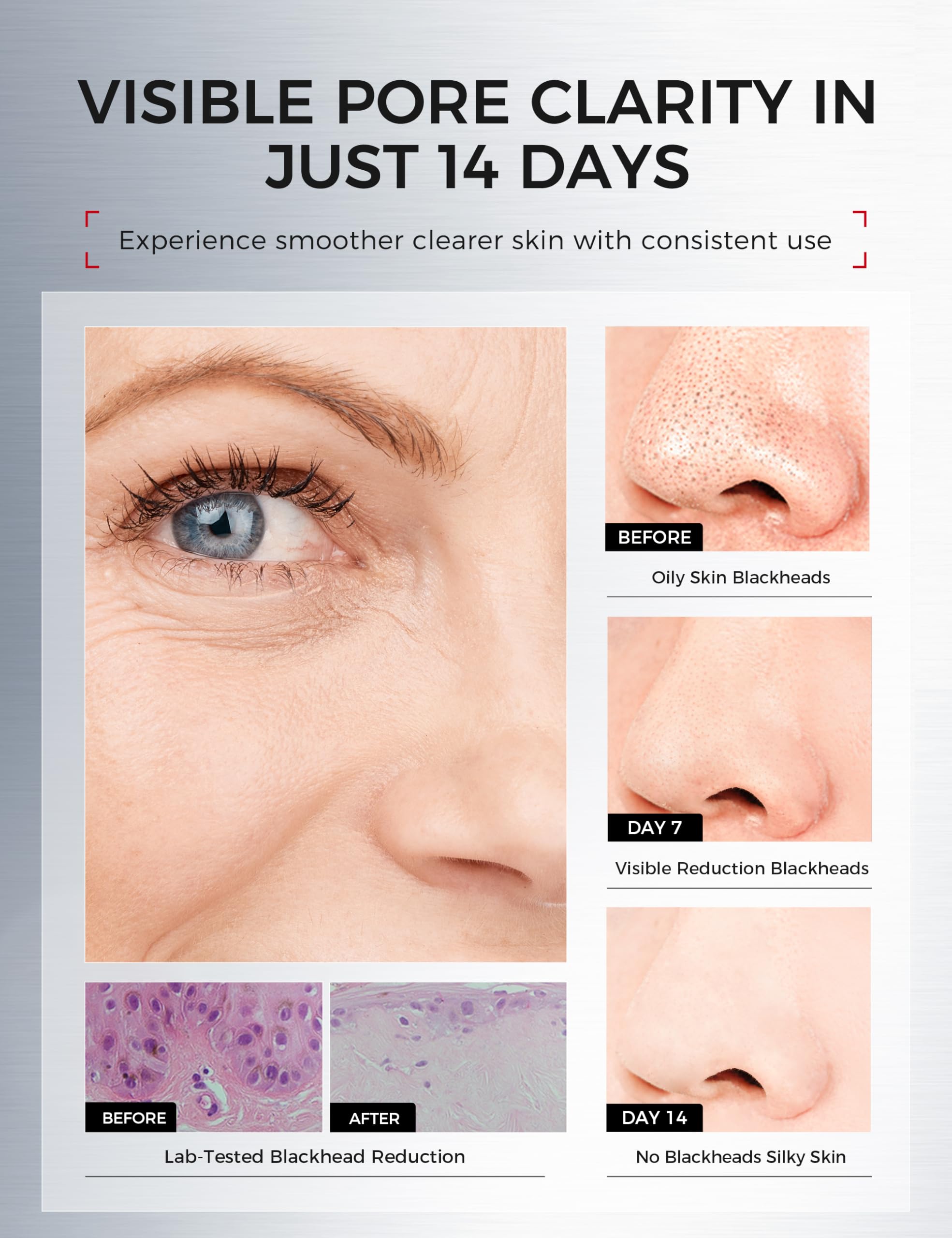 NING DERMOLOGIE before and after comparison showing refined pores