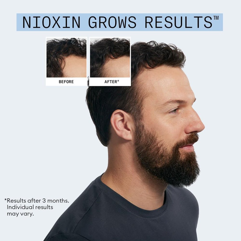 Nioxin kit held in hand to show travel-friendly size and convenient daily use
