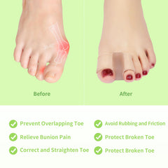 Niupiour toe separator worn under a sock providing gentle support
