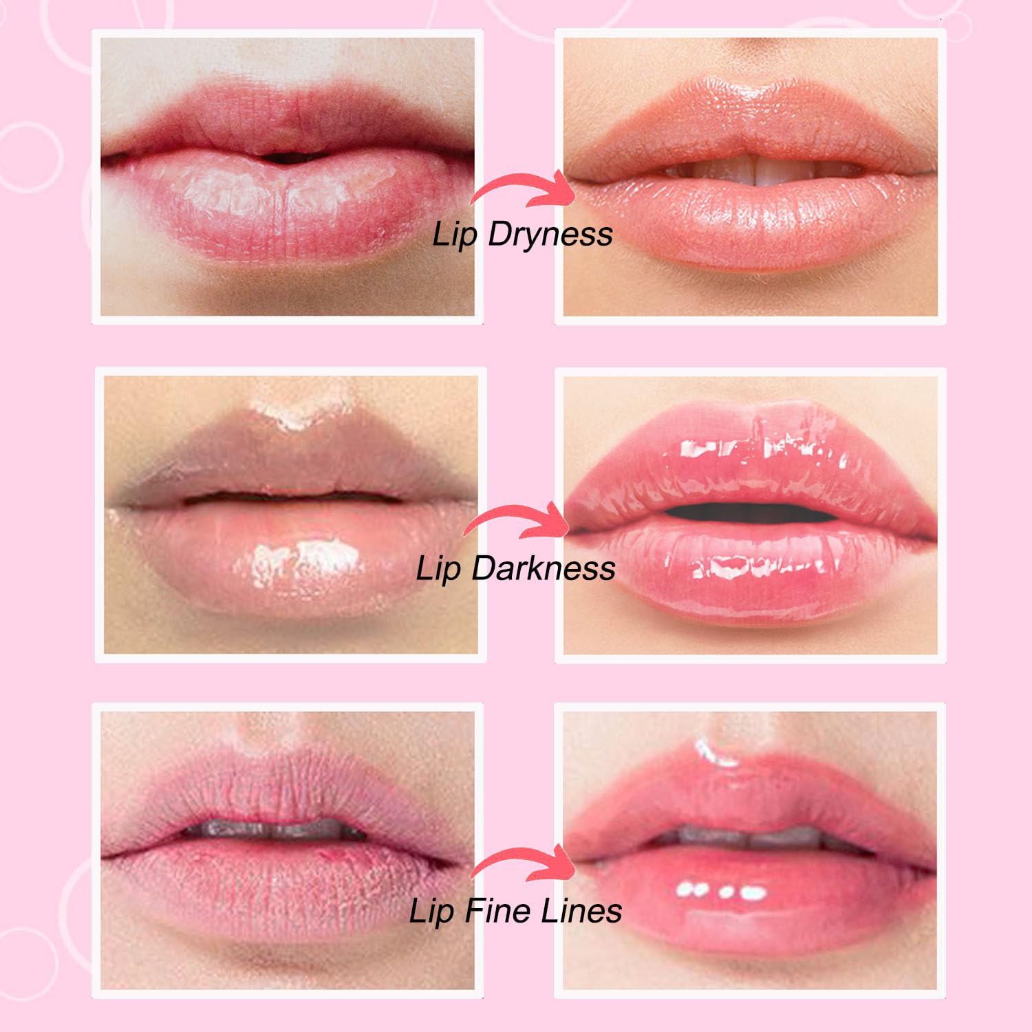 NIYET patch applied to lips demonstrating secure fit and immediate soothing effect