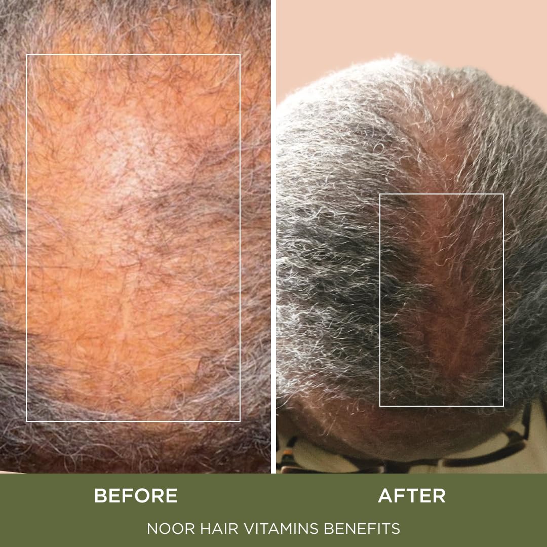 NOOR HAIR ingredient icons showing vitamins and targeted benefits
