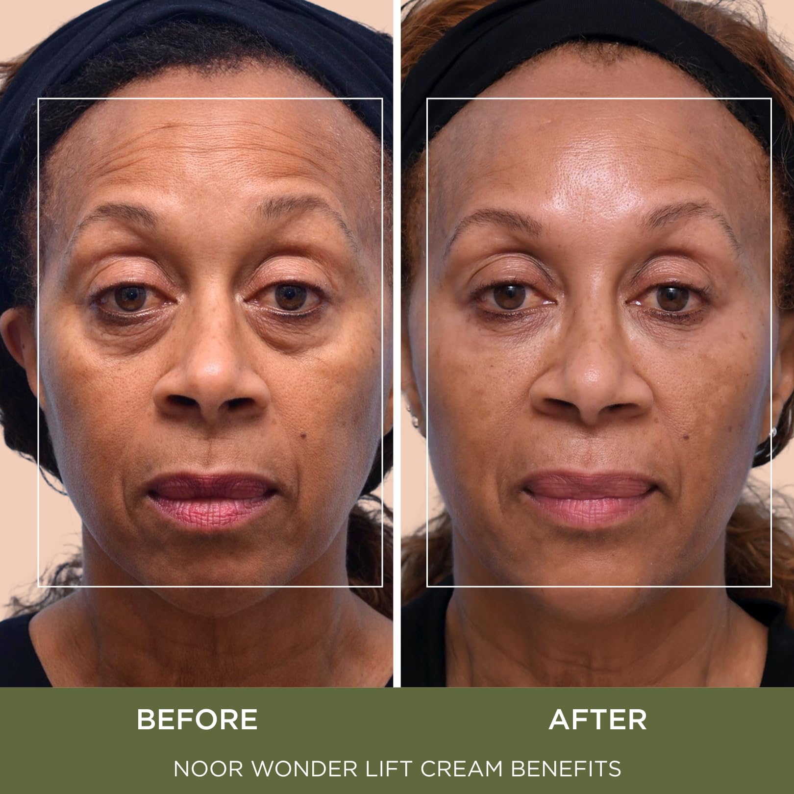 NOOR HAIR Syn‑Ake peptide ingredient display highlighting age-smoothing benefit
