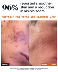 Norse Organics ingredients sea buckthorn and rosehip highlighting botanical potency