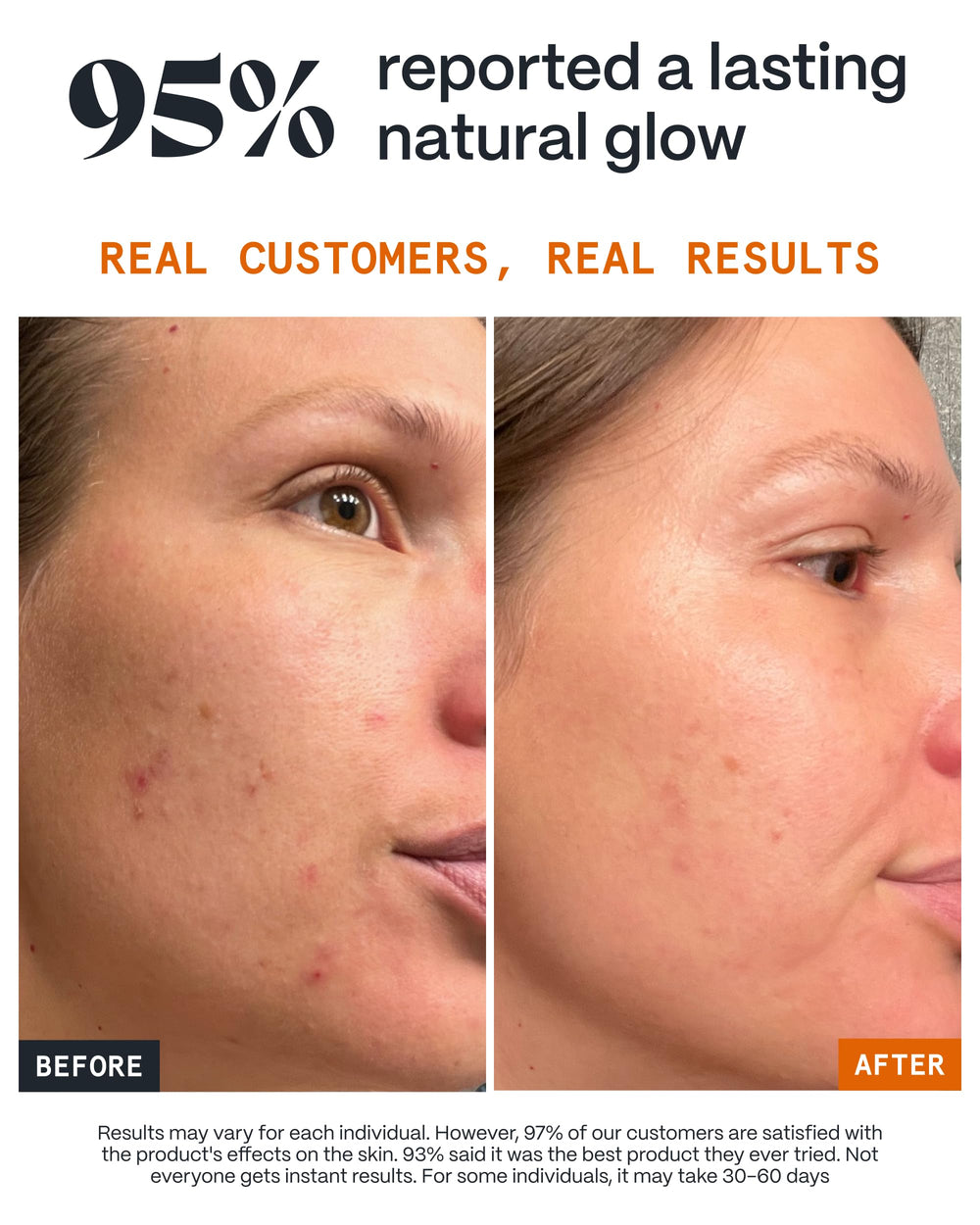 Norse Organics balm applied to blemish demonstrating targeted calming benefit
