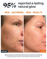 Norse Organics balm applied to blemish demonstrating targeted calming benefit