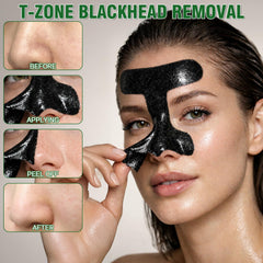 Nozerix peeled mask detail revealing extracted impurities for smoother skin