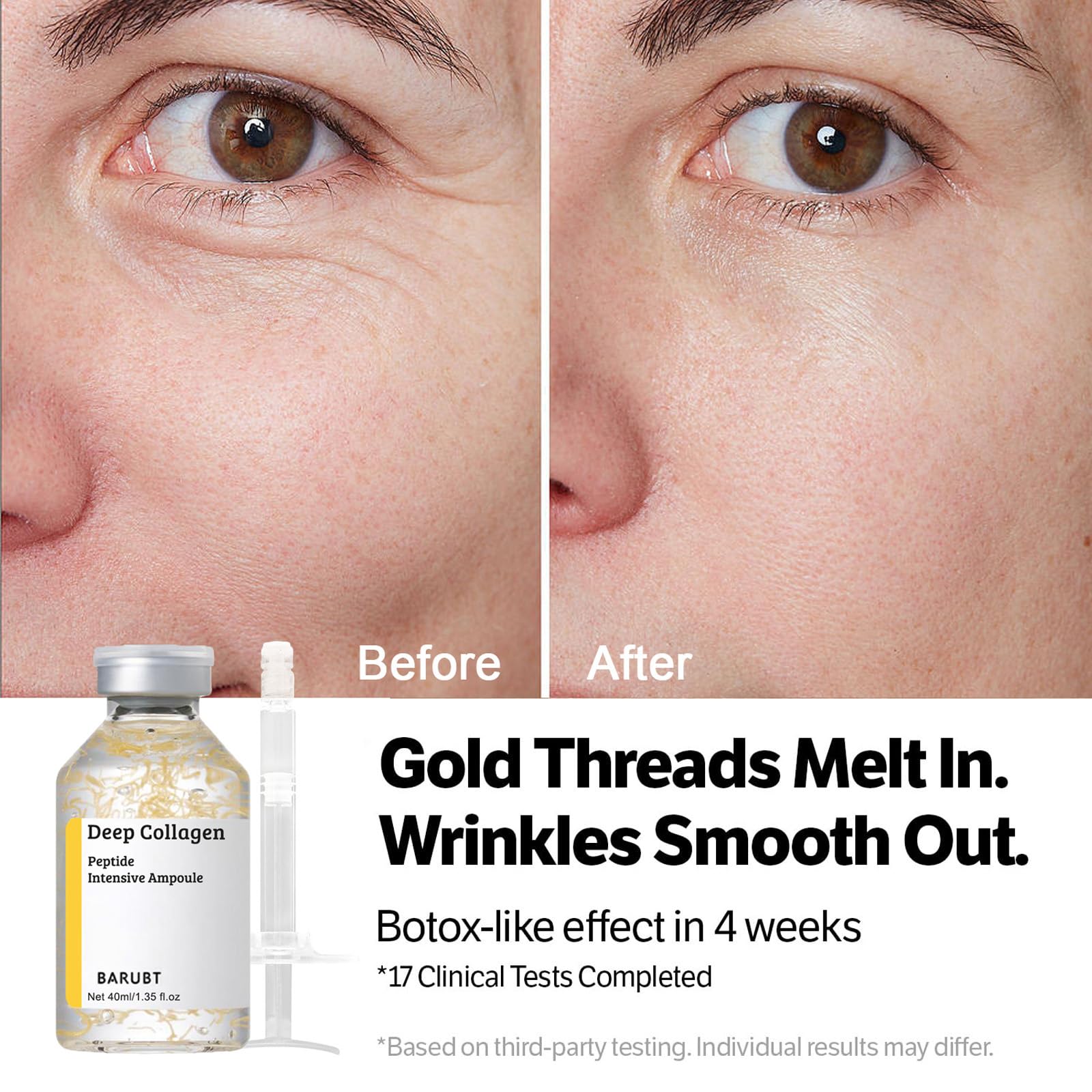 NureBe before and after skin comparison illustrating smoother, hydrated skin