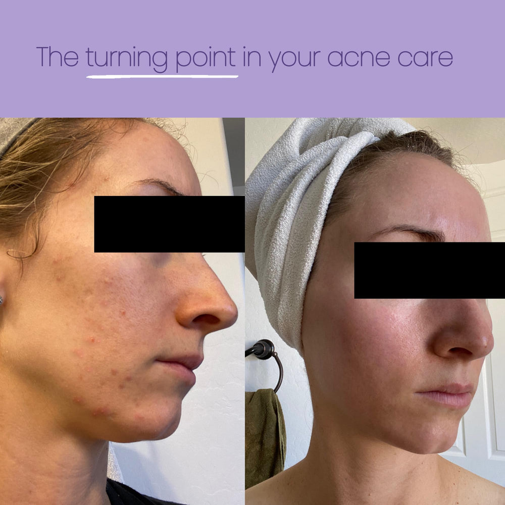 Nutriscribe towel removing makeup demonstrating gentle cleansing
