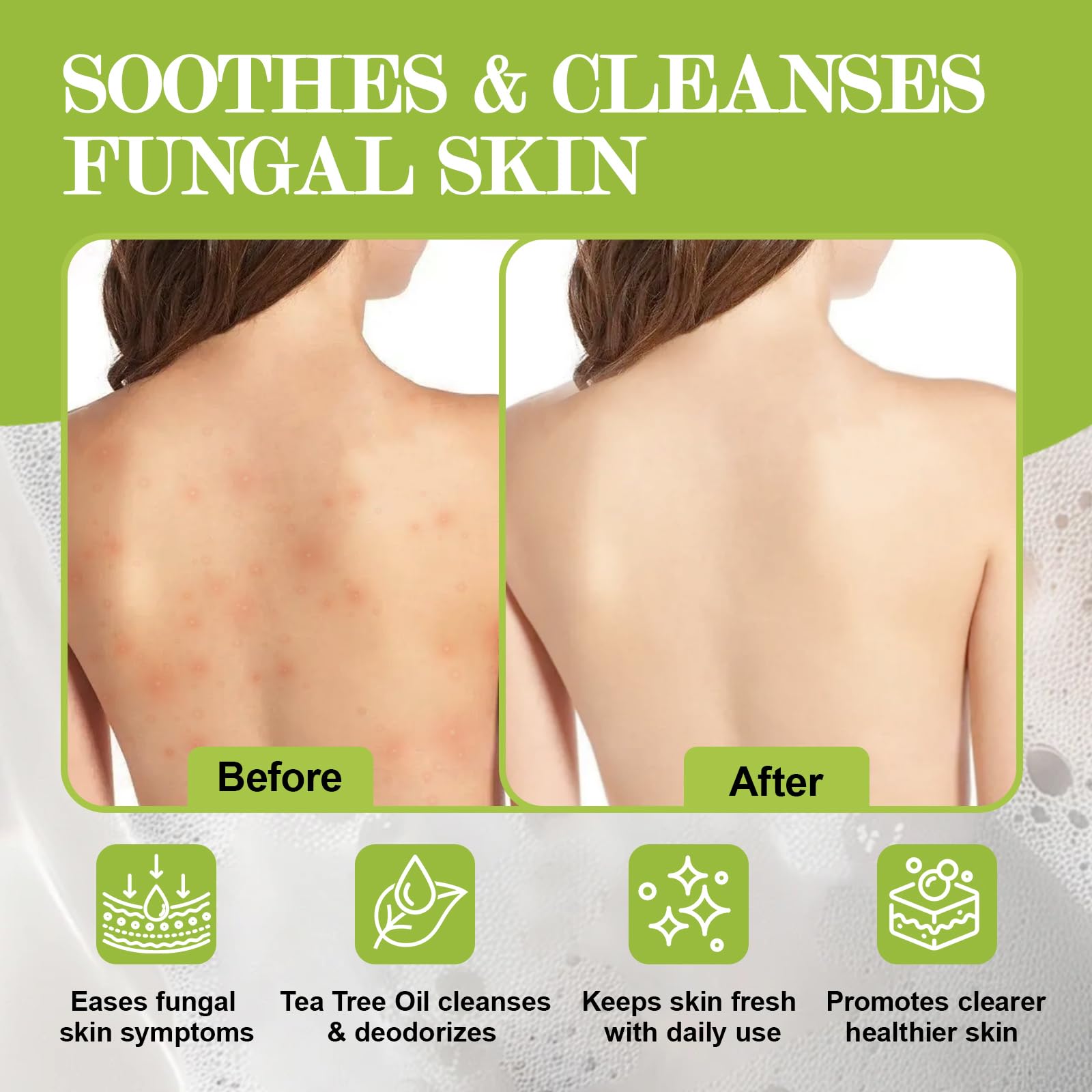 NXPPYY ingredient label showing tolnaftate and NDC for product transparency