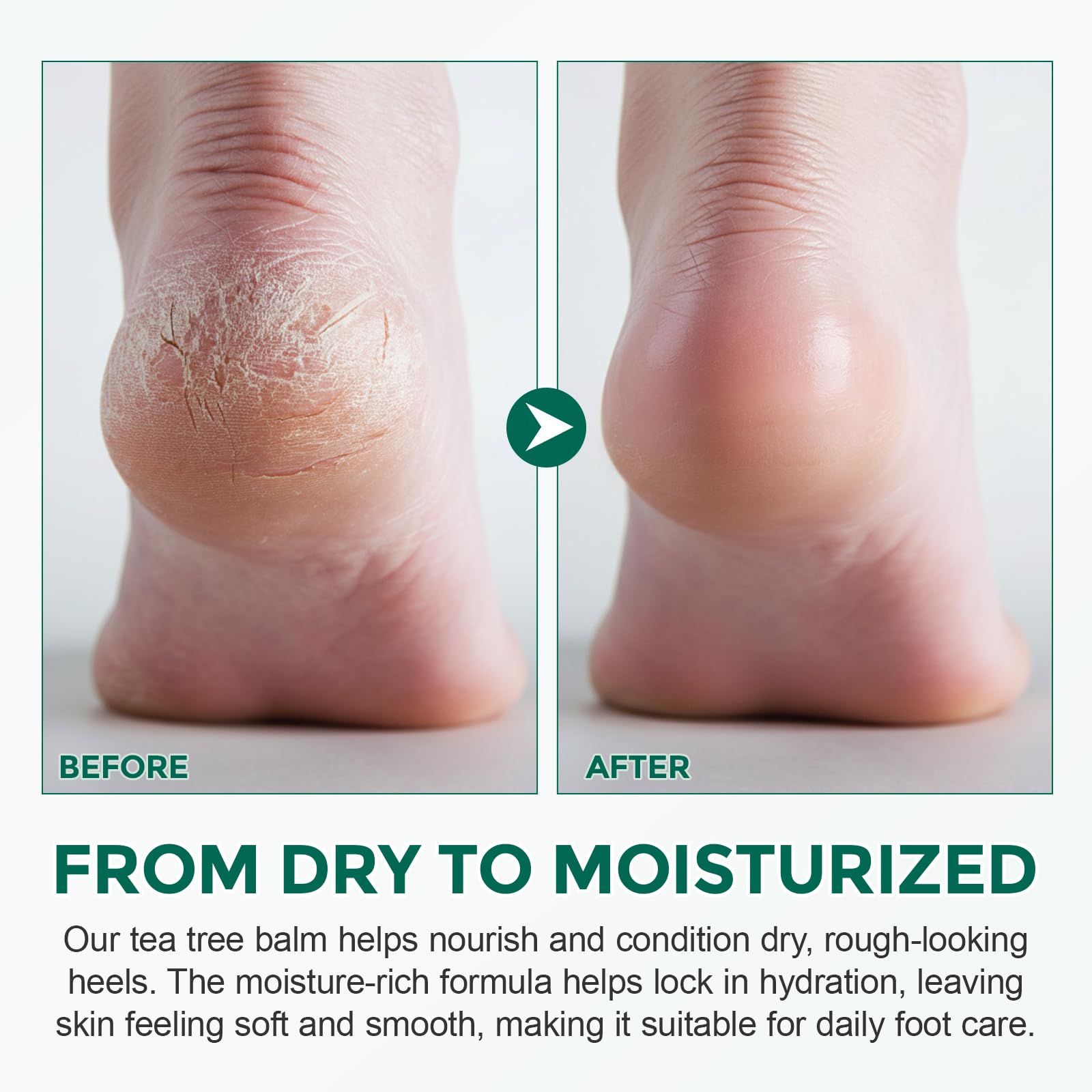 Nyloriaine ingredient layout with tea tree and aloe showing botanical benefit