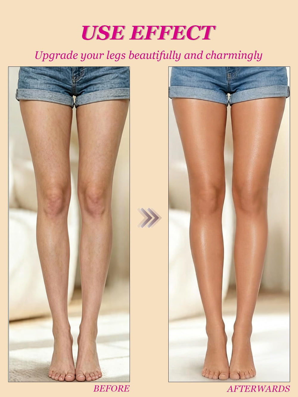 O'CHEAL before and after legs showing concealed veins and smoother skin benefit