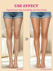 O'CHEAL before and after legs showing concealed veins and smoother skin benefit