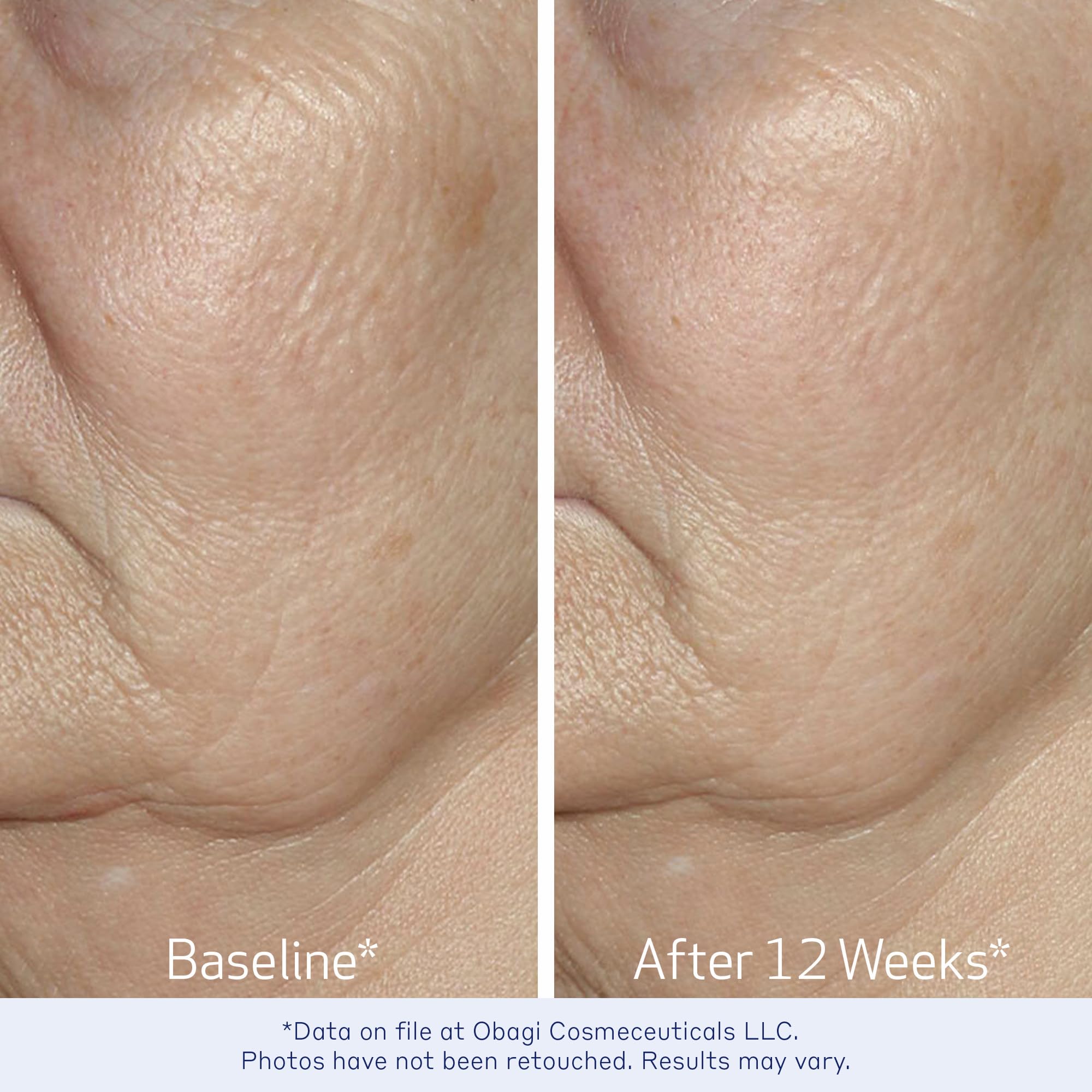Obagi ELASTIderm 1oz bottle scale comparison demonstrating compact travel-friendly size